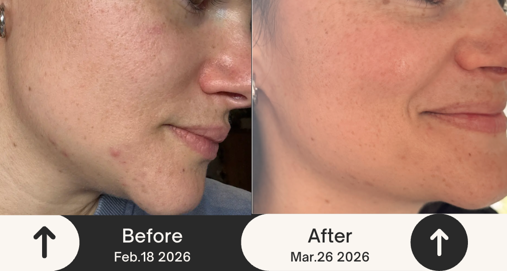 스크린샷 2026-03-29 오후 11.08.03.png