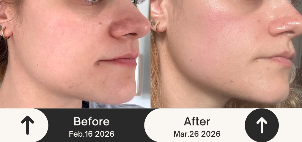 스크린샷 2026-03-29 오후 11.08.13.png