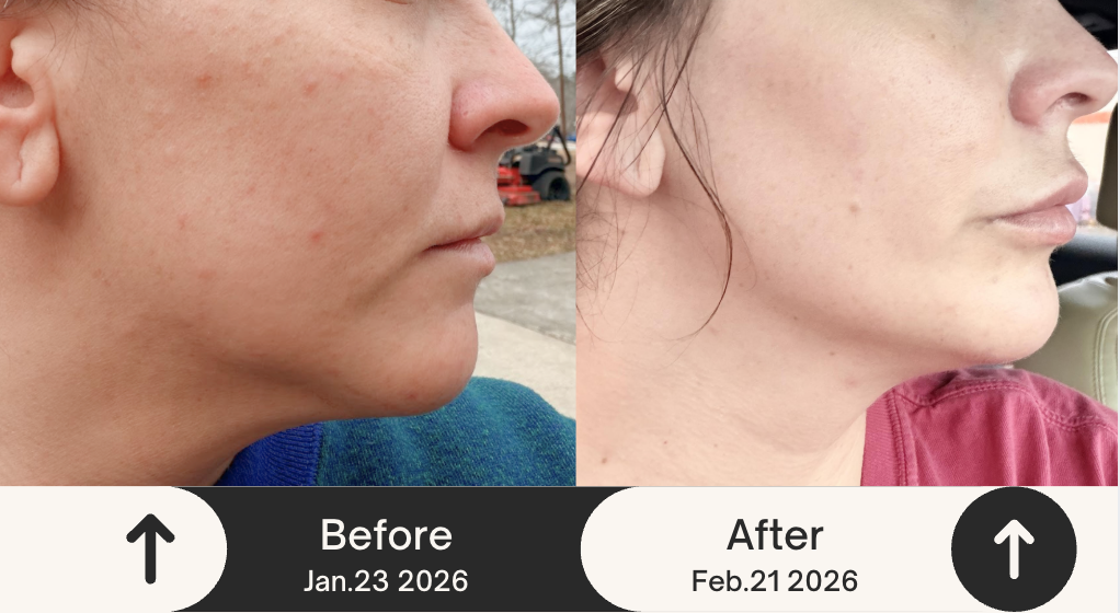 스크린샷 2026-03-29 오후 11.07.23.png