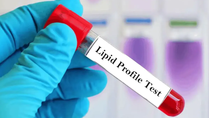 20260324 _ 콜레스테롤 검사는 소아기부터 — 미국 심장학회 새 지침 _ 2-2.png