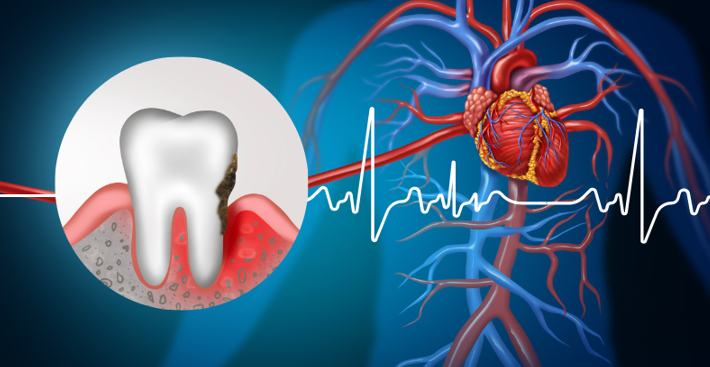 20260318 _ 어릴 때 충치가 많다면…성인 심장병 위험도 함께 높아진다 _ 2.png