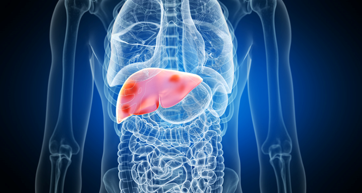 20260405 _ 간경변 환자, 치과 검진만으로 간암 위험 27% 낮아졌다 _ 2.png