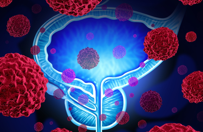 20260201 _ 전립선암 치료, 당뇨약 SGLT2 억제제의 신호 _ 2-2.png