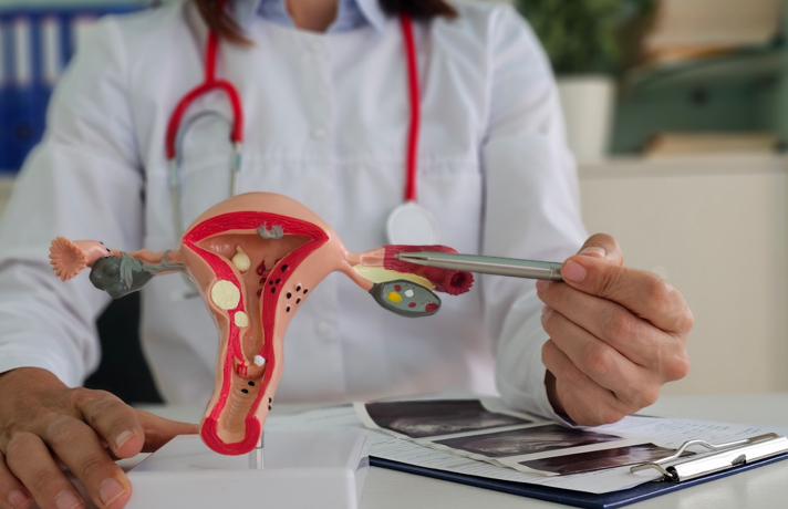 20260213 _ 난소암 예방, 수술 때 난관 제거가 왜 중요할까 _ 2-1.png