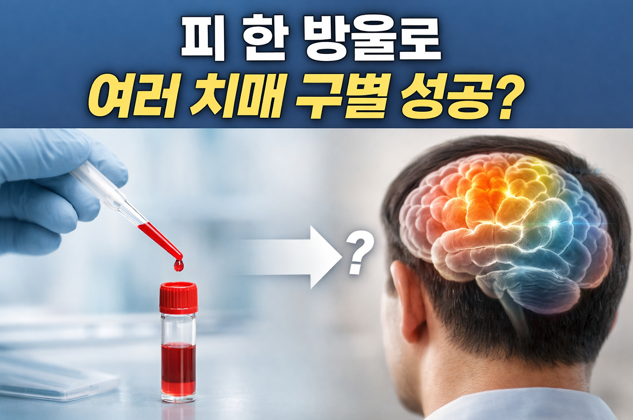20260404 _ 치매 혈액검사, AI가 한 방울로 여러 종류를 구별한다 _ 2-3.png