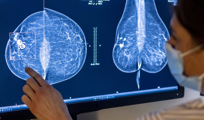 20260207 _ 유방암 검진, AI가 ‘놓친 암’을 줄일까 _ 2.png