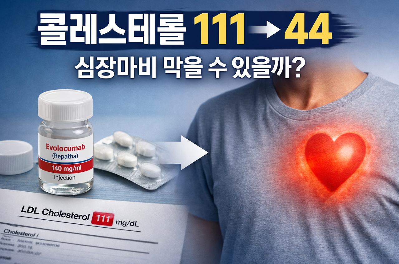 20260404 _ 당뇨병 환자의 첫 심장마비, 콜레스테롤을 일찍 낮추면 막을 수 있다 _ 2-4.png