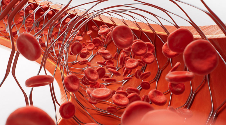 20260420 _ 심부정맥혈전증 후유증, 스텐트 시술로 증상 줄일 수 있다 _ 2-1.png