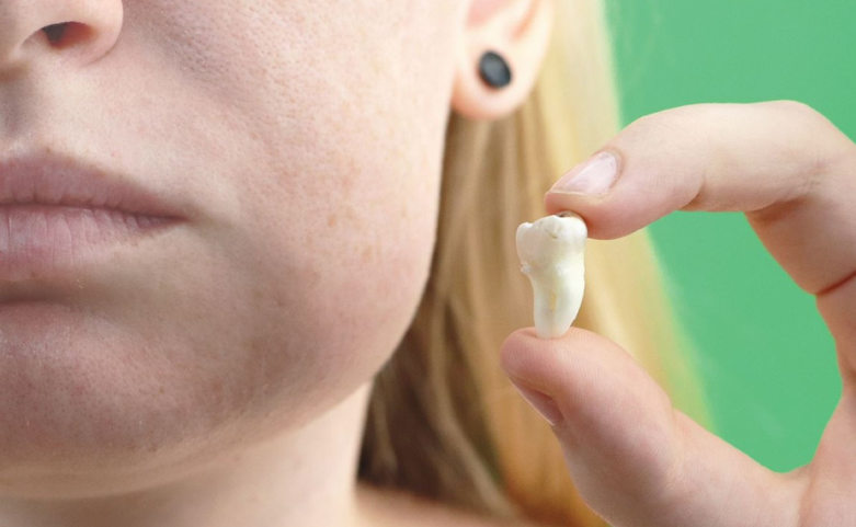 20260419 _ 치아를 잃으면 살이 찐다 _ 2-1.png