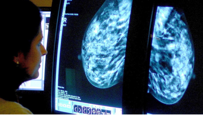 20260207 _ 유방암 검진, AI가 ‘놓친 암’을 줄일까 _ 2-2.png