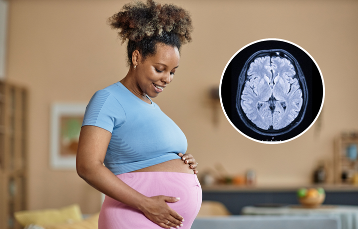 20260226 _ 임신 뇌 변화, 둘째 임신도 ‘새 흔적’ 남긴다 _ 2-1.png