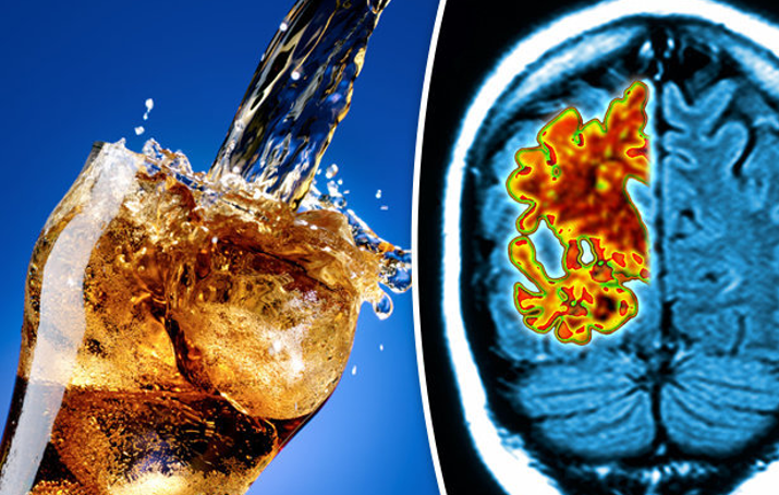 20260206 _ 다이어트 탄산음료, 치매 4배↑ ‘당뇨·비만’이 열쇠 _ 2-2.png