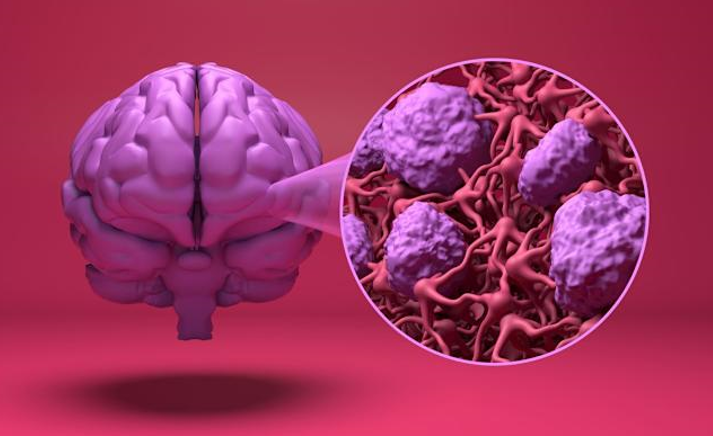 20260328 _ 세균 감염이 치매 위험을 높인다 _ 2-1.png