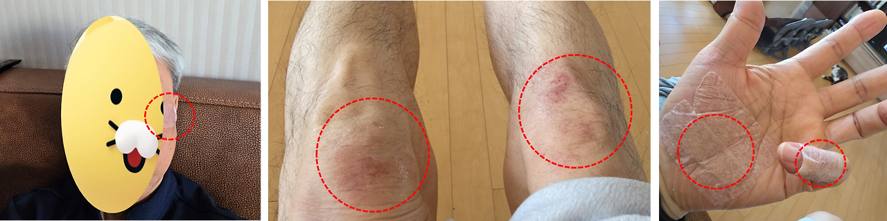 결혼기념일 부상.png