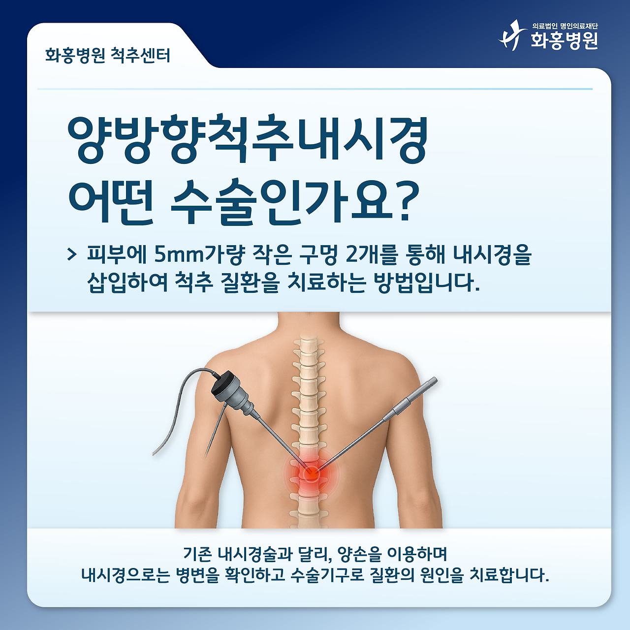 아무것도 모르는 양방향척추내시경.png