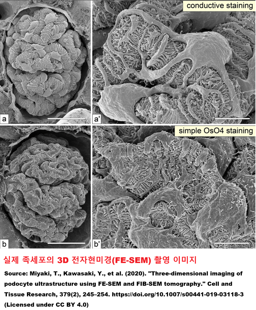 podocyte_real.png