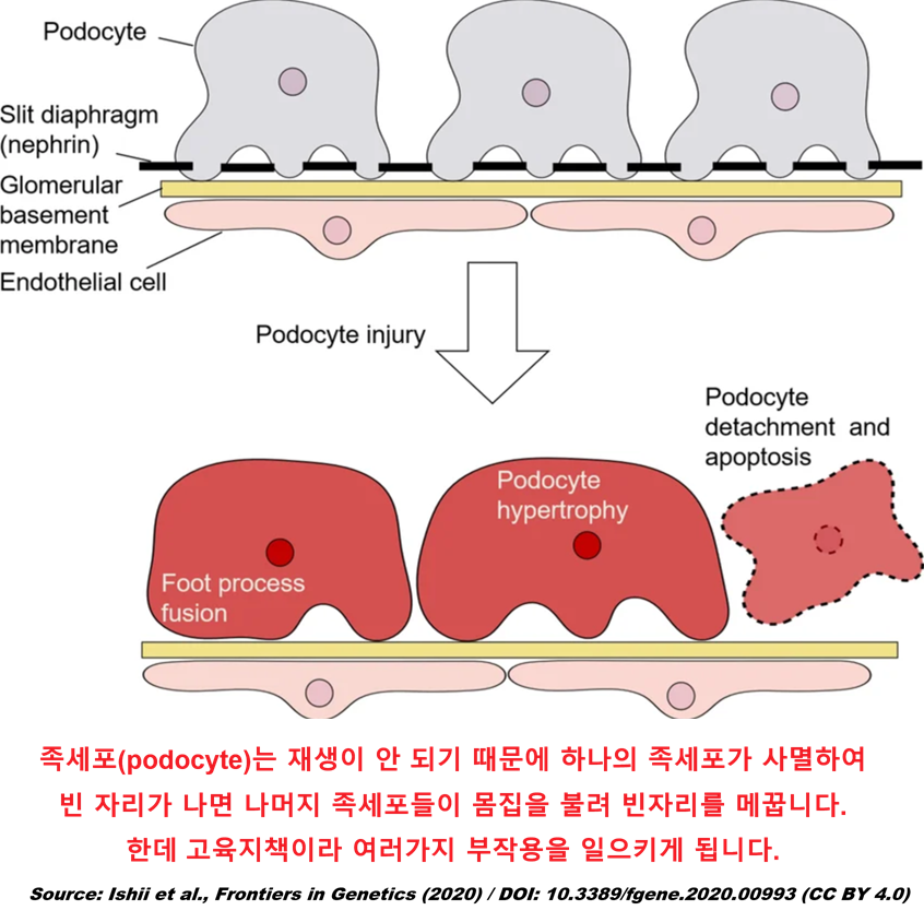 podocyteenlargement.png