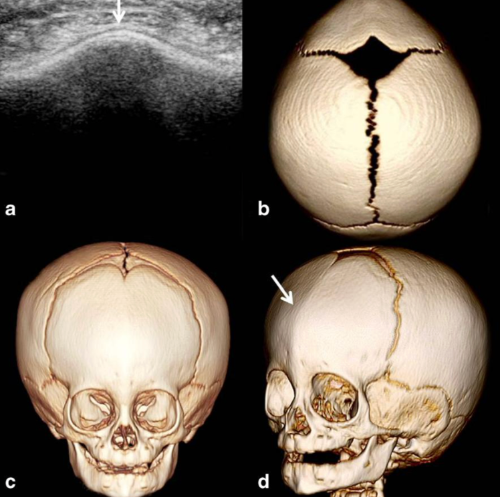 스크린샷 2026-01-27 09.31.43.png