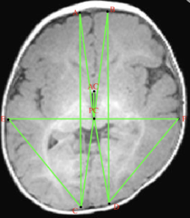 스크린샷 2026-01-26 08.45.34.png