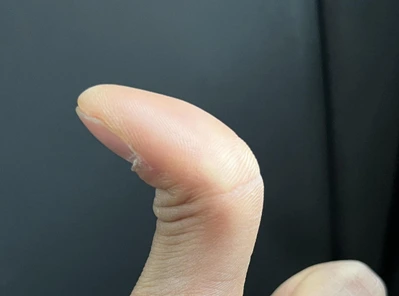 SE-3c980910-ca8d-497e-86bf-5cf78502660d.png?type=w1