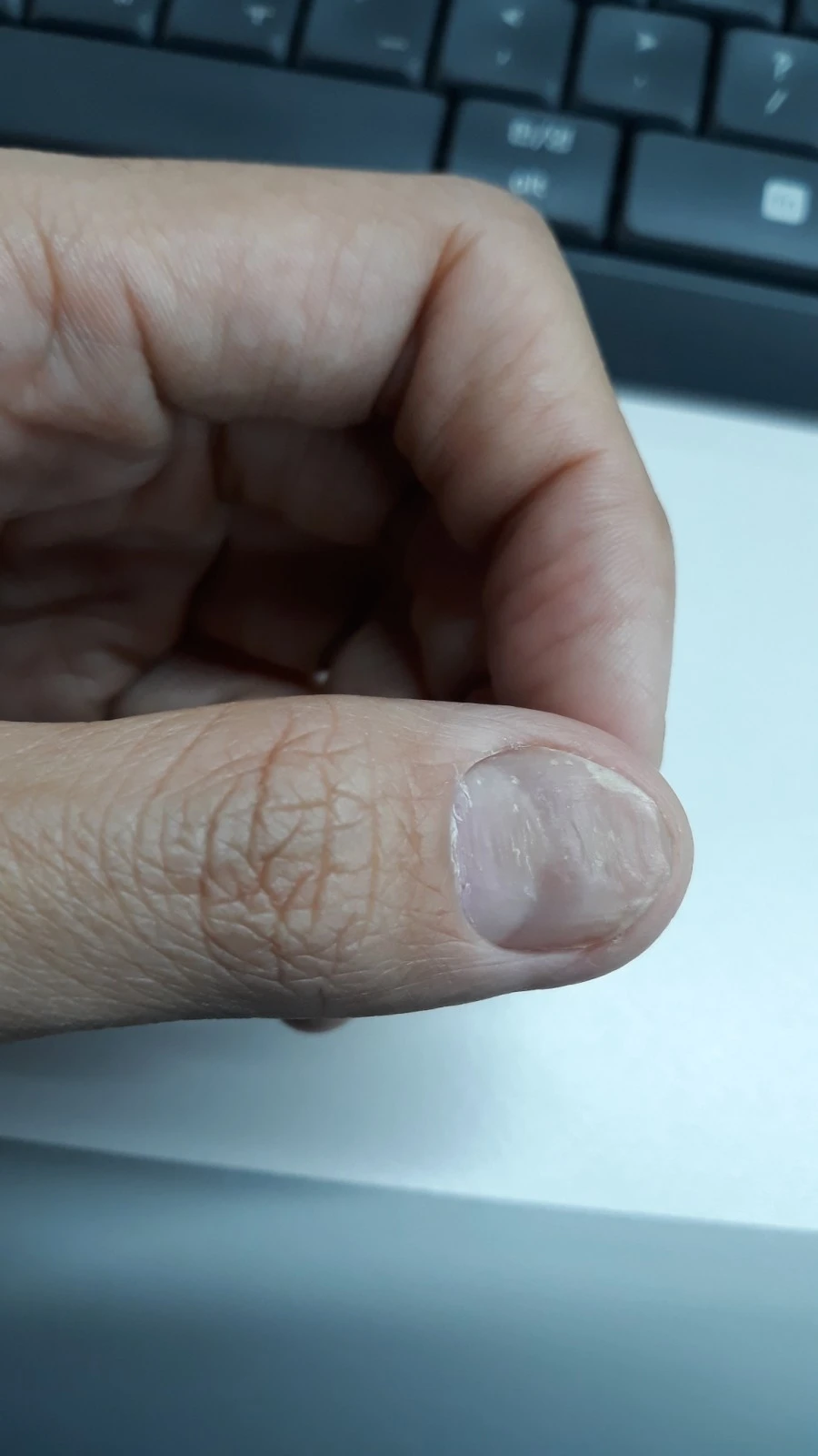 1574684357367.jpg?type=w1