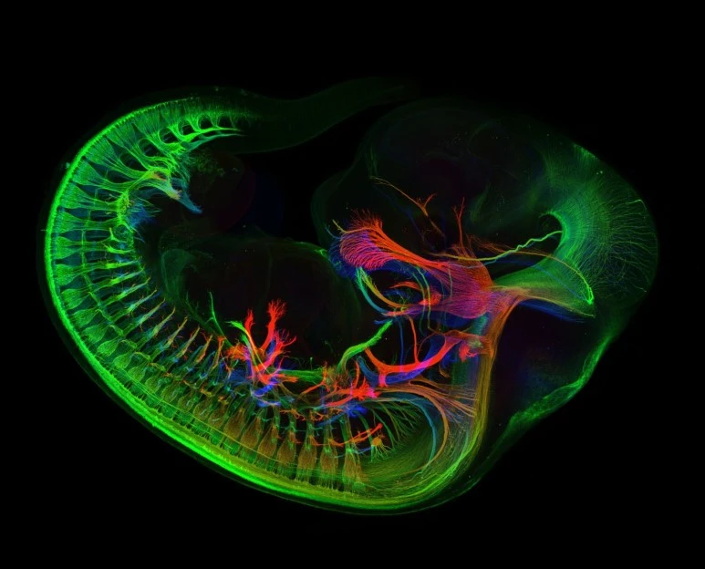 a43ab33a7c6620d2a0fce015257fd74c.jpg?type=w773