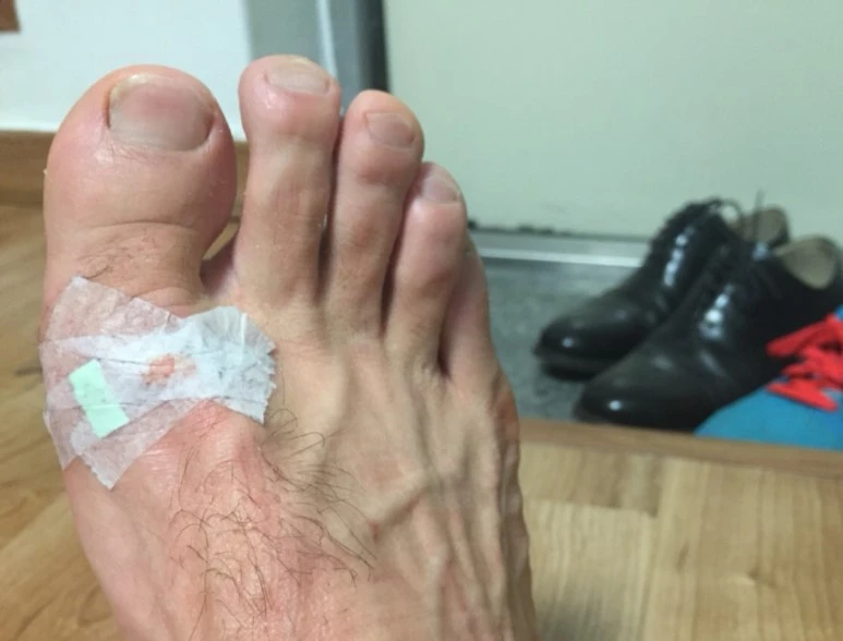 attachImage_99670226.jpeg?type=w773