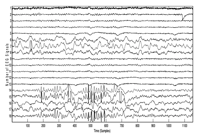 xzD3xwL6hUchffBtWA1d87Wkn5WslCU6pFwsGiHiVZctxKFXFWl8navzcuK1k5q6-dm7gAaBOKGR2hjGWh57sBzCzF6W8Qd2mDGzTneEVW-HbMYJp6-xMdbsTekh6X1hE0QkZJk0hx72v96IU18Mgck
