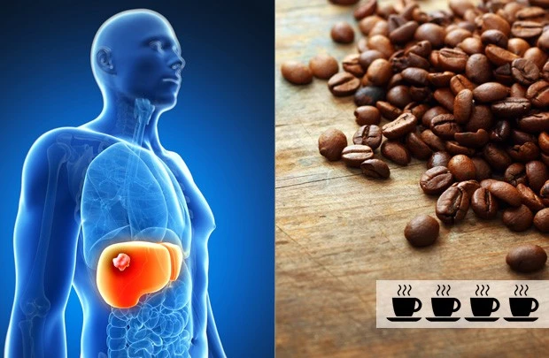 coffee-cancer-liver_0.jpg?type=w966
