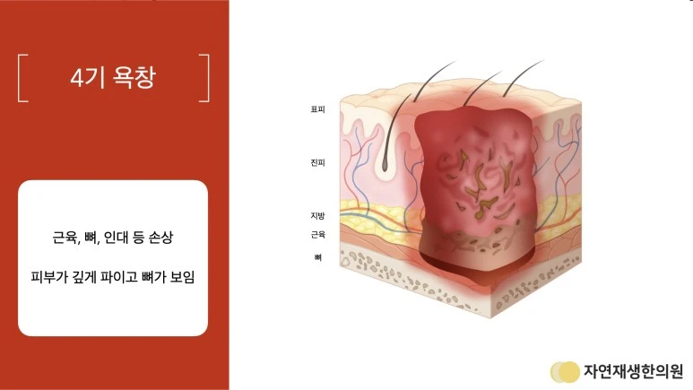 상처_설명_자료.011.jpeg