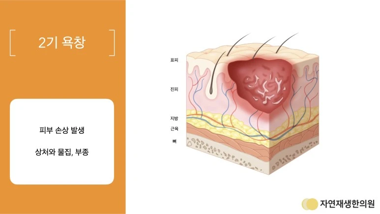 상처_설명_자료.009.jpeg