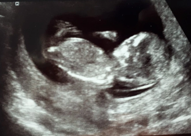 SE-02708aac-c767-45cf-8673-7767d0c8bc0f.jpg?type=w1