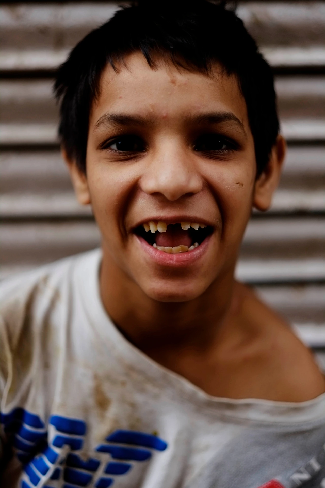 이빨 빠진 아이.JPG