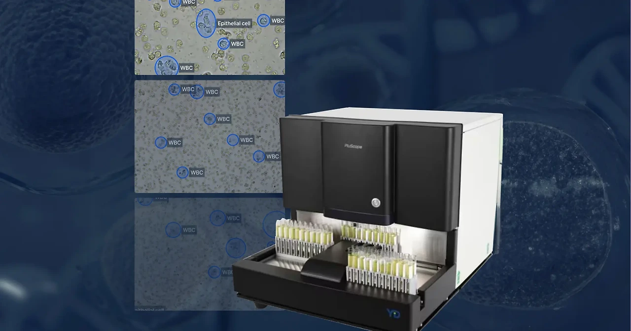 ?url=https%3A%2F%2Fsource.inblog.dev%2Fpost_image%2F2025-01-24T05%3A27%3A45.923Z-f7d75aea-1f49-4ae9-b002-d6b0400133e3&w=1920&q=75