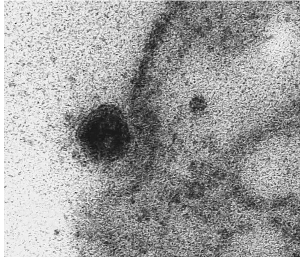 3-1 코로나바이러스 (한겨레, ).JPG