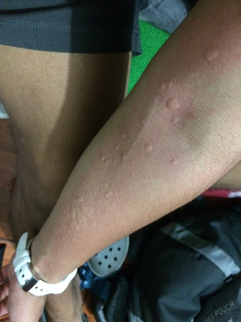 IMG_7095.jpg?type=w1