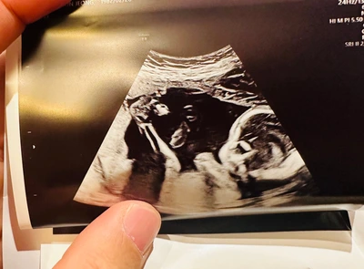 SE-c5971ce6-896d-4d39-b779-b82138ed8aa1.jpg?type=w966