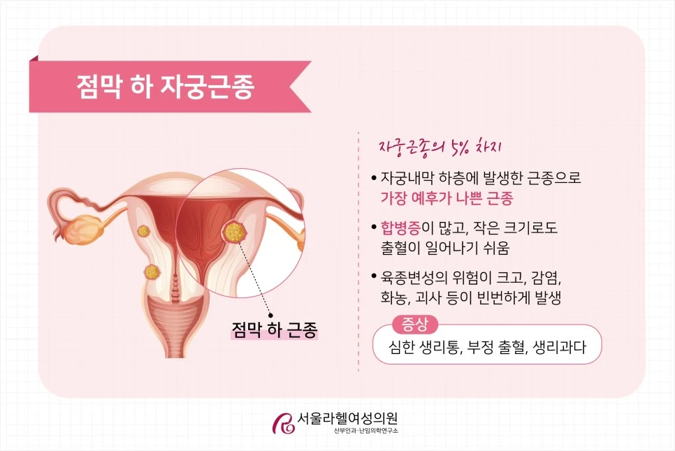 SE-0f6153f6-dd0c-4e5a-bd6e-f1ddddcfe0ac.jpg?type=w966