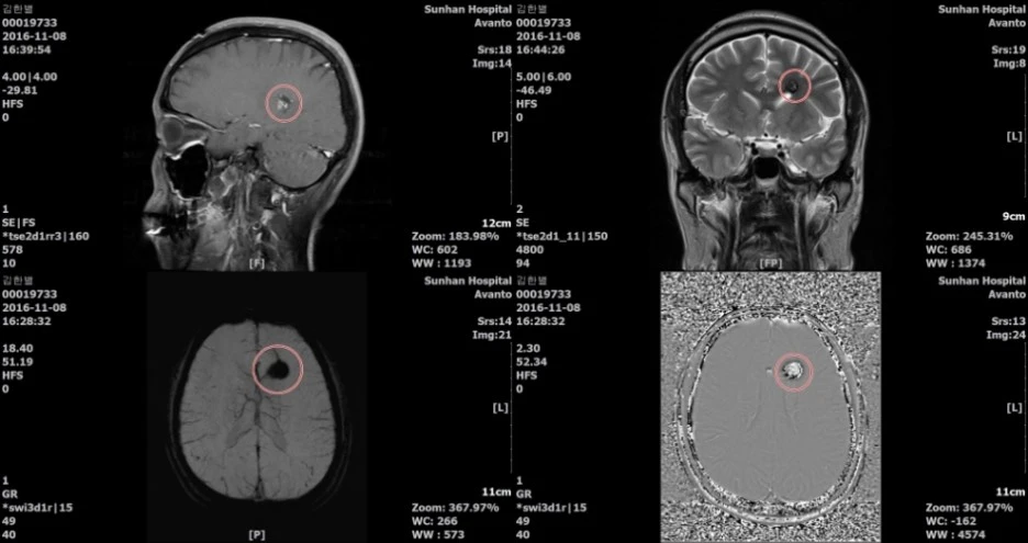 IMG_0085-down-side.jpg?type=w1