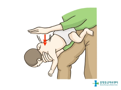 first_aid_basics_5_2.gif?type=w1