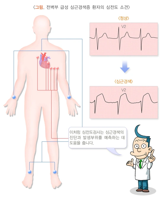 image_(14).png?type=w1