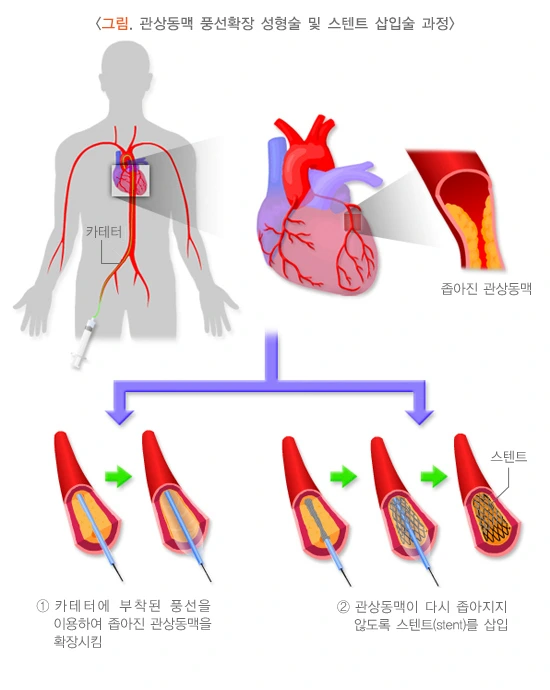 image_(13).png?type=w1