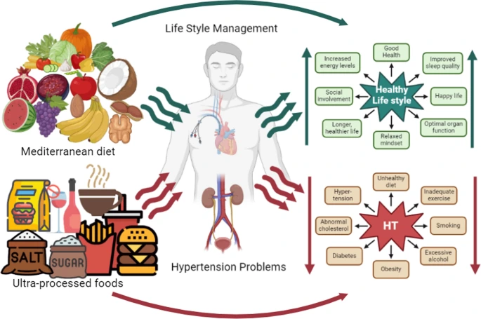 art_3A10.png?type=w1