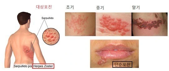 mosaxqa3SN.png?type=w1