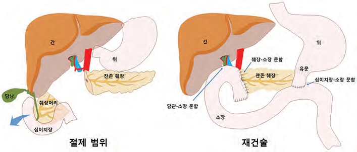 MDAxNjMwNTkxNTY2MzU0.-5_UEcjn7oh_FSHtPrfD975pGdXJo65s_E3chPOELlMg.SklgrTh34A.png?type=w1