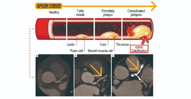 _EC_84_9D_ED_9A_8C_ED_99_94.png?type=w1