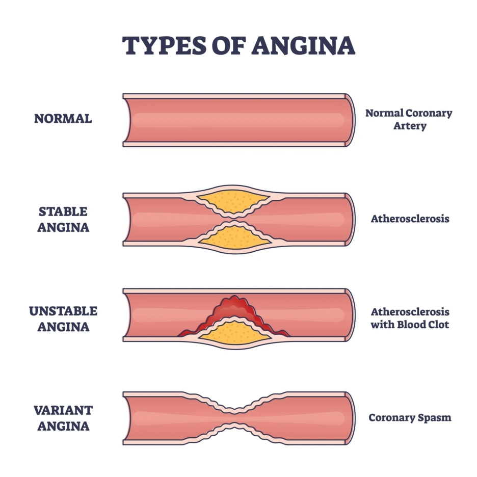 shutterstock_2048787008-1536x1536.png?type=w1