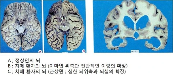 36272_craw1.png?type=w1