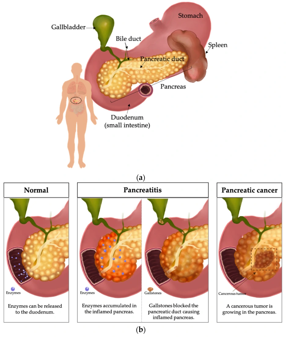 biomedicines-11-02557-g001.png?type=w1