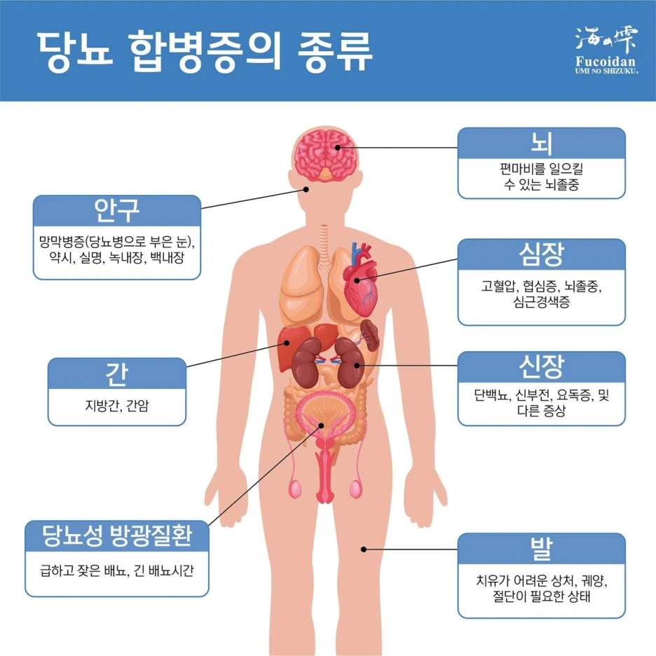 1794949484_s1Cr0S4Q_EB8BB9EB87A8ED95A9EBB391ECA69D.png?type=w1